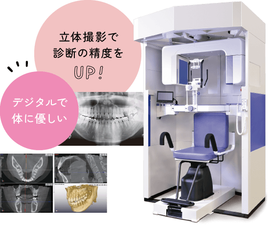 立体撮影で診断の精度をUP!デジタルで体に優しい